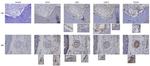 CD10 Antibody in Immunohistochemistry (Paraffin) (IHC (P))