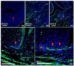 KCTD1 Antibody in Immunohistochemistry (Paraffin) (IHC (P))