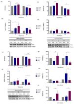 Kir6.2 (KCNJ11) Antibody in Western Blot (WB)