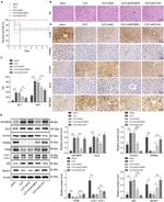 GLI2 Antibody in Western Blot, Immunohistochemistry (Paraffin) (WB, IHC (P))