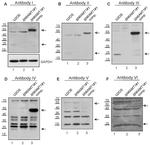 N6AMT1 Antibody in Western Blot (WB)