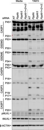 PPP6R1 Antibody in Western Blot (WB)