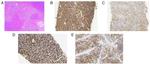 c-Kit Antibody in Immunohistochemistry (Paraffin) (IHC (P))