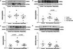 HDAC8 Antibody in Western Blot (WB)