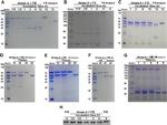 Factor VIII Antibody in Western Blot (WB)