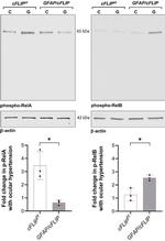 Phospho-RelB (Ser552) Antibody in Western Blot (WB)