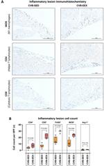 CD4 Antibody in Immunohistochemistry (Paraffin) (IHC (P))