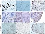 MMP9 Antibody in Immunohistochemistry (Paraffin) (IHC (P))