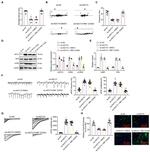Adenylate Cyclase 3 Antibody in Western Blot (WB)