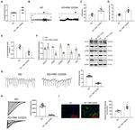 Adenylate Cyclase 3 Antibody in Western Blot (WB)