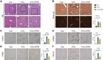 CD11b Antibody in Immunohistochemistry (Paraffin) (IHC (P))