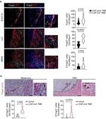 FOXP3 Antibody in Immunohistochemistry (Paraffin) (IHC (P))