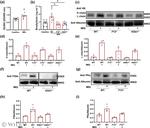 Factor XII Antibody in Western Blot (WB)