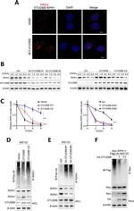 OTUD6B Antibody in Western Blot (WB)