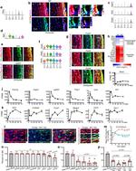 Galectin 3 Antibody in Immunohistochemistry (IHC)