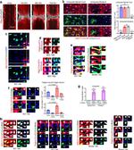SOX9 Antibody in Immunohistochemistry (IHC)