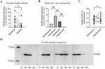 GPR41 Antibody in Western Blot (WB)