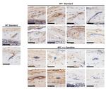 MGP Antibody in Immunohistochemistry (IHC)
