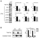 Phospho-Tau (Ser396) Antibody in Western Blot (WB)