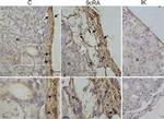 INHA Antibody in Immunohistochemistry (IHC)