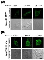 SARS Envelope Protein Antibody in Immunohistochemistry (PFA fixed) (IHC (PFA))