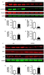 VCP Antibody in Western Blot (WB)