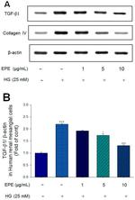 TGF beta-1 Antibody in Western Blot (WB)