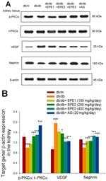 TGF beta-1 Antibody in Western Blot (WB)
