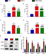 FGL2 Antibody in Western Blot (WB)