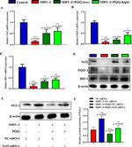 FGL2 Antibody in Western Blot (WB)