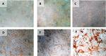 HSP27 Antibody in Immunohistochemistry (PFA fixed) (IHC (PFA))