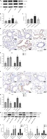 Nrf2 Antibody in Western Blot (WB)