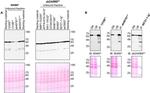 Syk Antibody in Western Blot, Immunoprecipitation (WB, IP)