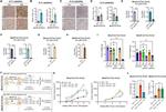VEGF Receptor 1 Antibody in Immunohistochemistry (Paraffin) (IHC (P))