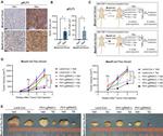 VEGF Receptor 1 Antibody in Immunohistochemistry (Paraffin) (IHC (P))