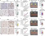 VEGF Receptor 1 Antibody in Immunohistochemistry (Paraffin) (IHC (P))