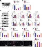 NOX4 Antibody in Western Blot (WB)