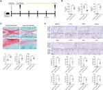 RIP3 Antibody in Immunohistochemistry (Paraffin) (IHC (P))