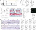 RIP3 Antibody in Immunohistochemistry (Paraffin) (IHC (P))