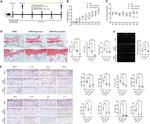RIP3 Antibody in Immunohistochemistry (Paraffin) (IHC (P))