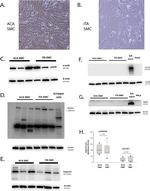 MYH11 Antibody in Western Blot (WB)