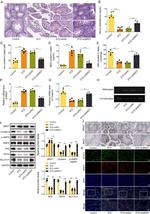 Nrf2 Antibody in Western Blot (WB)