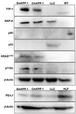 Ras (G12D Mutant) Antibody in Western Blot (WB)