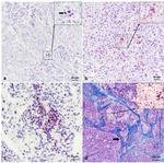 Placental Alkaline Phosphatase Antibody in Immunohistochemistry (Paraffin) (IHC (P))