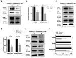 Phospho-ROR1 (Tyr786) Antibody in Western Blot (WB)