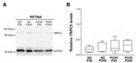 TRPC5 Antibody in Western Blot (WB)