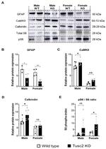 GFAP Antibody in Western Blot (WB)