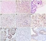 MUSK Antibody in Immunohistochemistry (PFA fixed) (IHC (PFA))