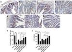 FOXP3 Antibody in Immunohistochemistry (Paraffin) (IHC (P))