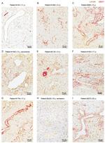 CD271 (NGF Receptor) Antibody in Immunohistochemistry (Paraffin) (IHC (P))